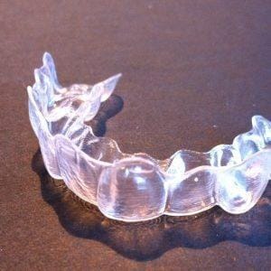 Invisalign_aligner