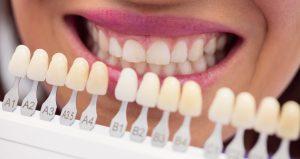 Dentist examining female patient with teeth shades at dental clinic