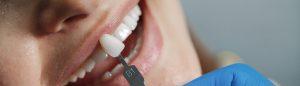 dentist-whiting-teeth