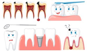Set of all types of teeth on white background